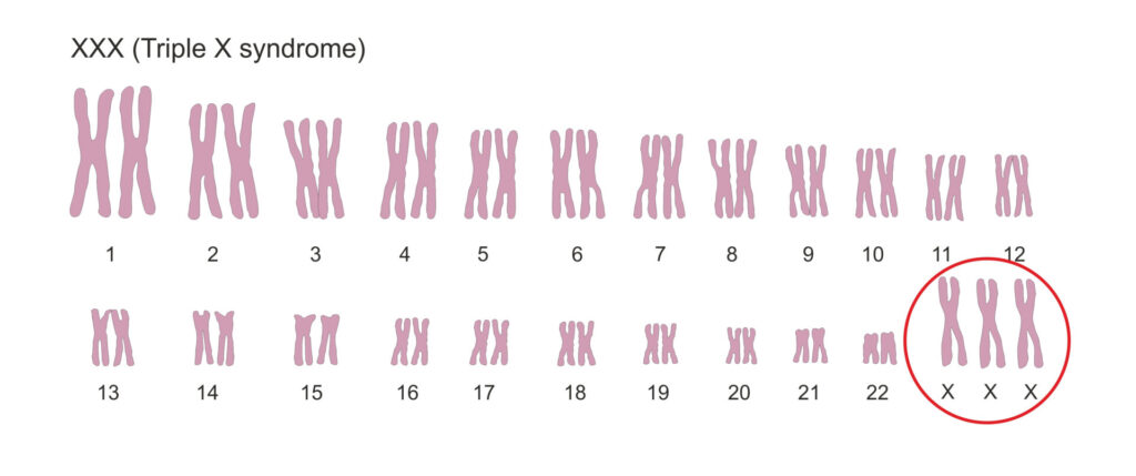 Een tekening van de 23 paar chromosomen van een mens. Ieder chromosoom heeft een soort H-vorm: twee wurmpjes die in het  midden verbonden zijn. Van het X-chromosoom zijn er geen twee maar drie. In totaal dus 47 chromosomen. 